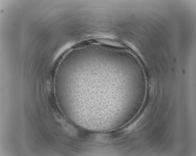 X0000065961163200603172017