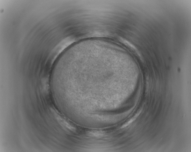 X0000065961170200603172017