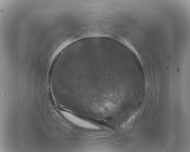 X0000065961173200603172017