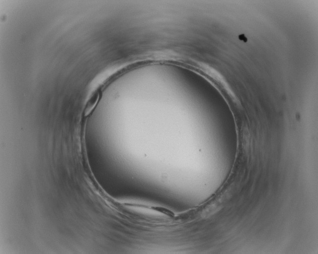 X0000065961176200603172017