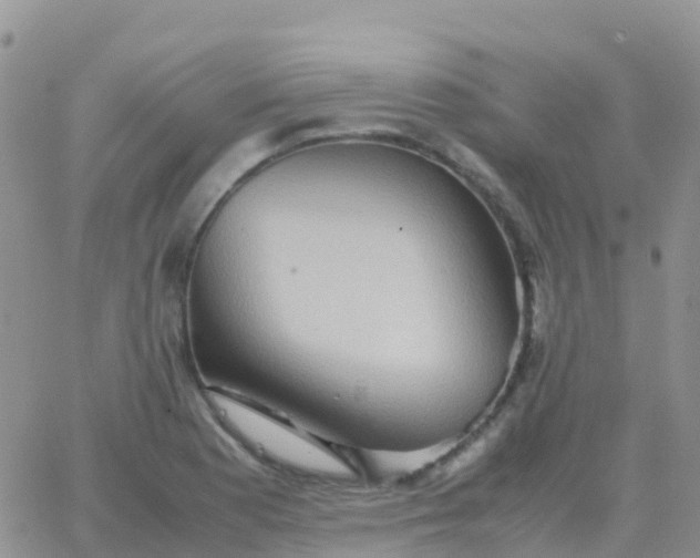 X0000065961177200603172017