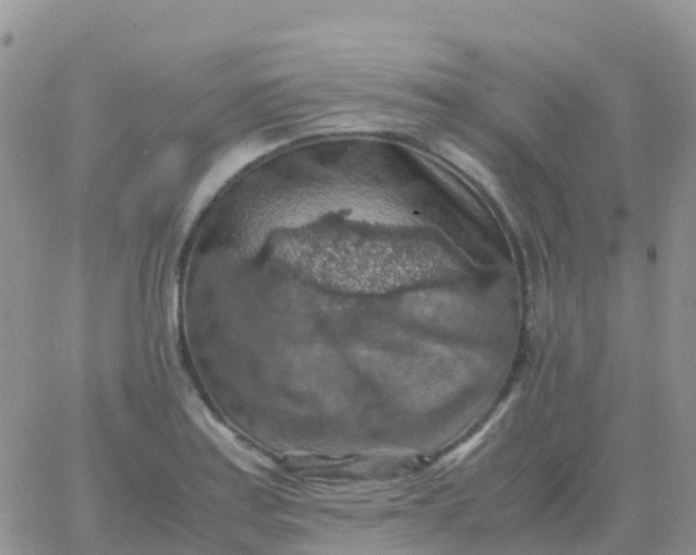 X0000065961179200603172017