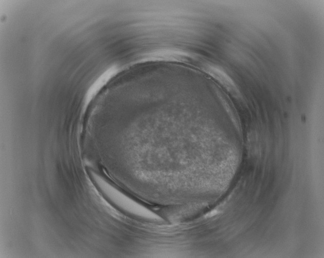 X0000065961180200603172017