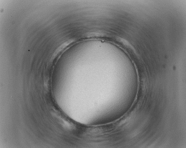 X0000065961217200603172016