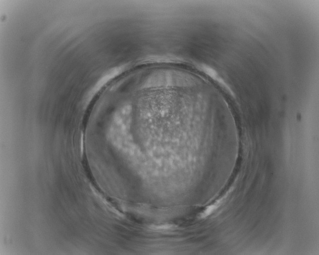 X0000065961221200603172016