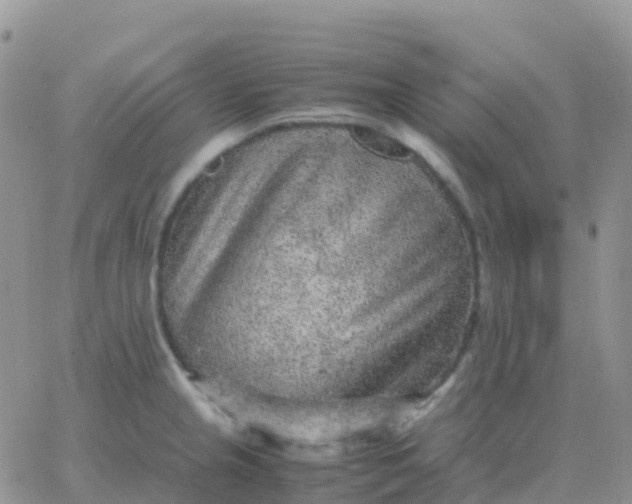 X0000065961237200603172016