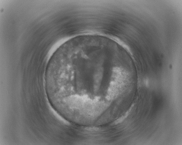 X0000065961239200603172016