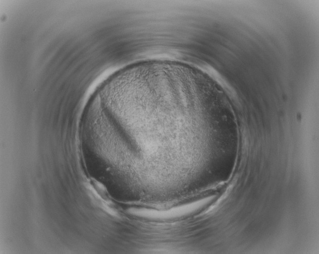 X0000065961240200603172016