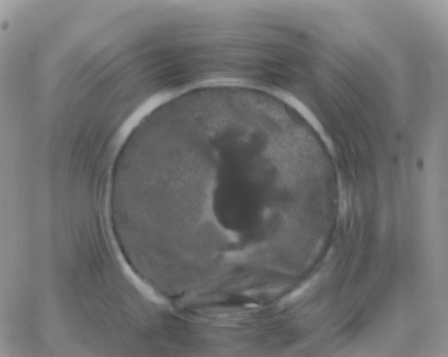 X0000065961245200603172016