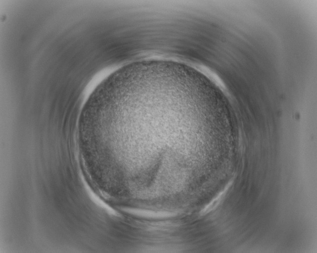 X0000065961247200603172016