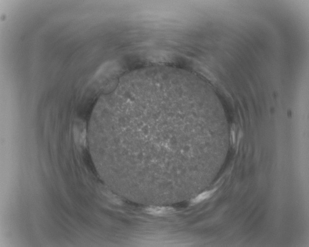 X0000065961251200603172016