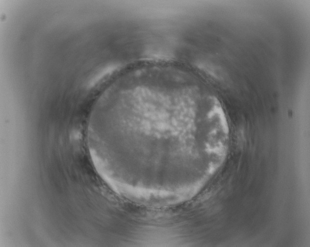 X0000065961254200603172016