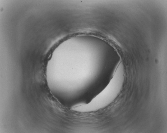 X0000065961256200603172016