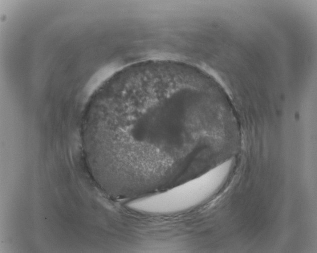 X0000065961263200603172015