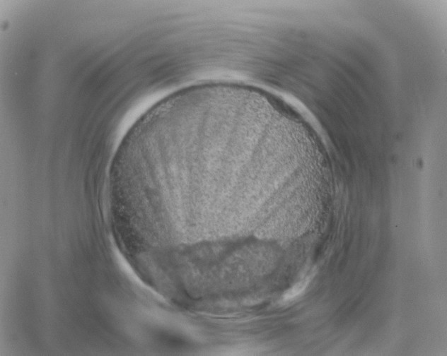 X0000065961295200603172015