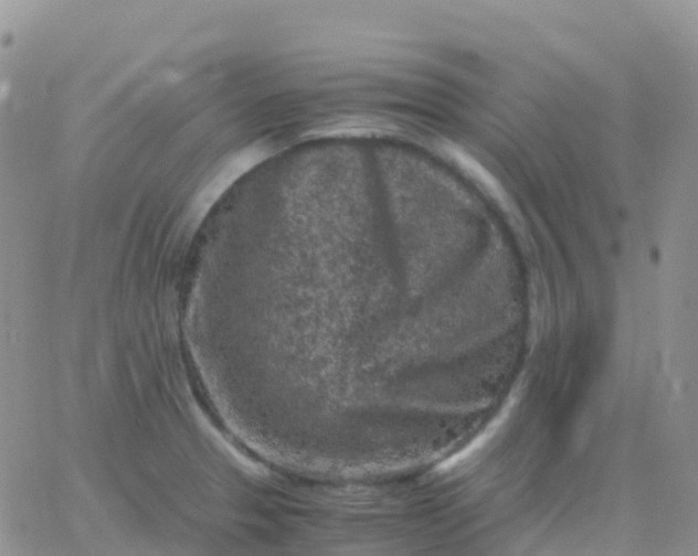 X0000065961329200603172015