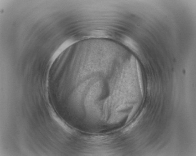 X0000065961378200603172014