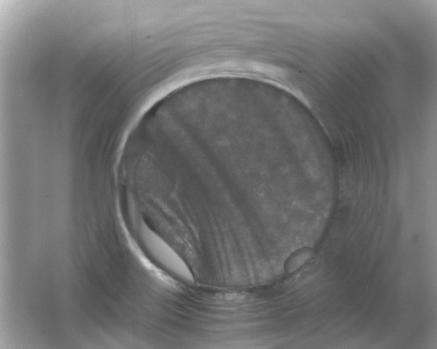 X0000065961515200603241833