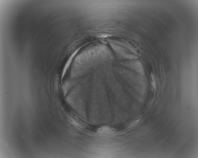 X0000065960231200603311820