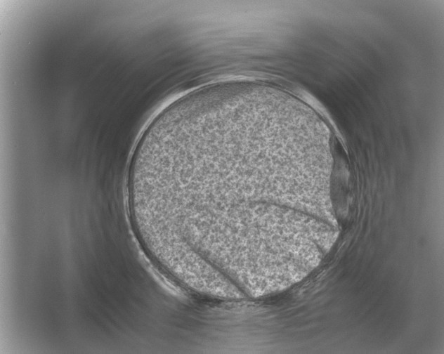 X0000065960811200603311810