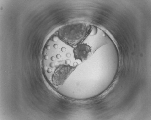 X0000065970957200603172047