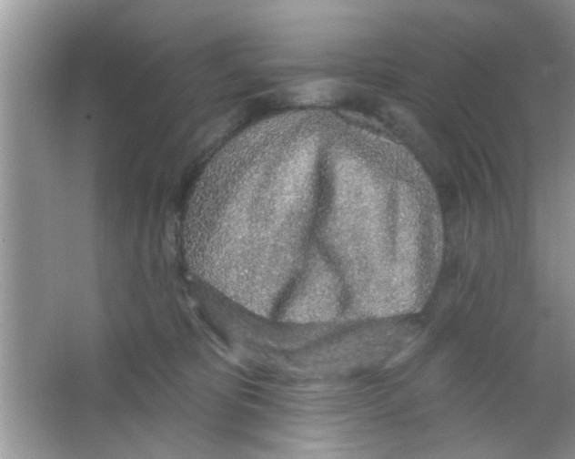 X0000065970325200603311845