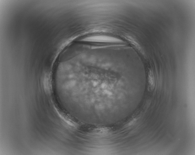 X0000065980492200603031158