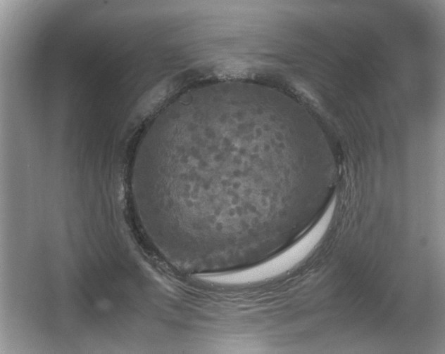 X0000065980687200603031155