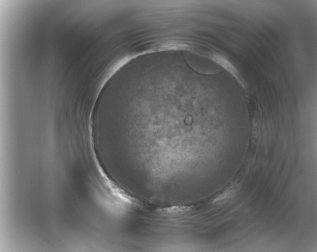 X0000065981047200603031149