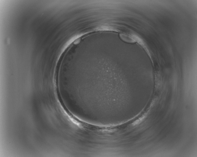 X0000065981141200603031148