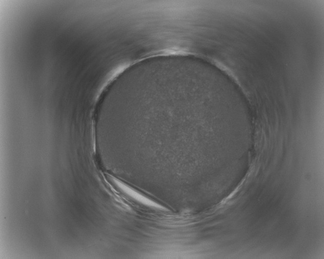 X0000065981171200603031147