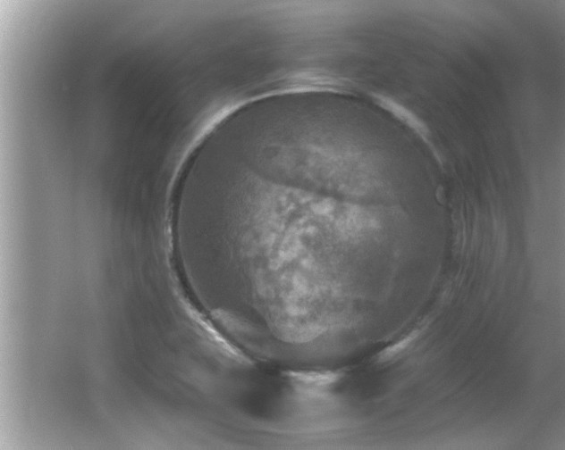 X0000065981415200603031143