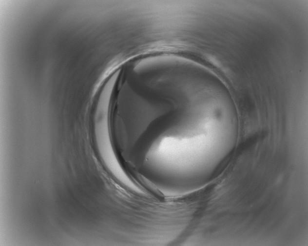 X0000065981459200603031142