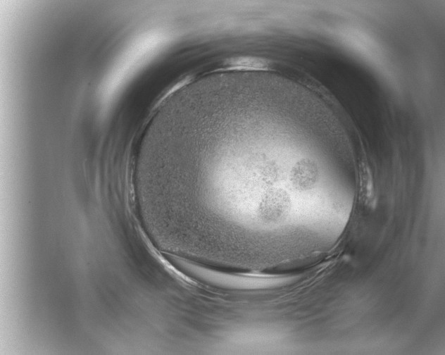 X0000065981487200603031141