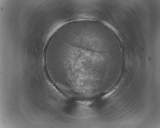 X0000065981415200603061203