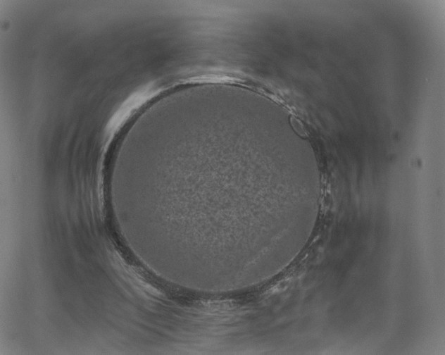 X0000065980296200603101429