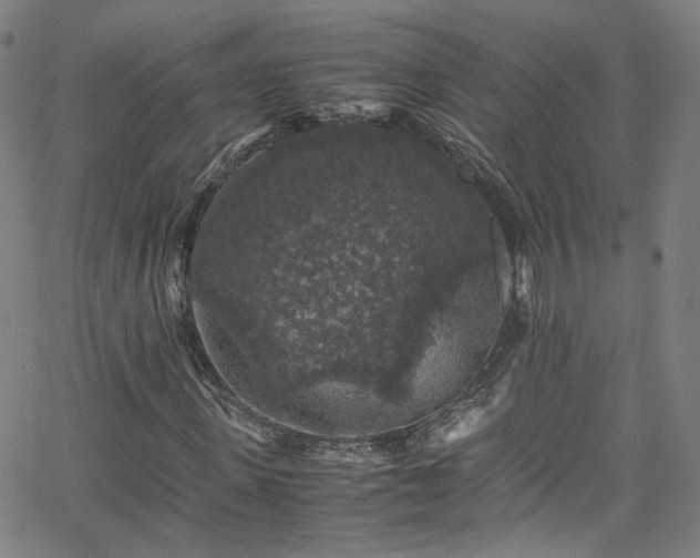 X0000065980915200603101418