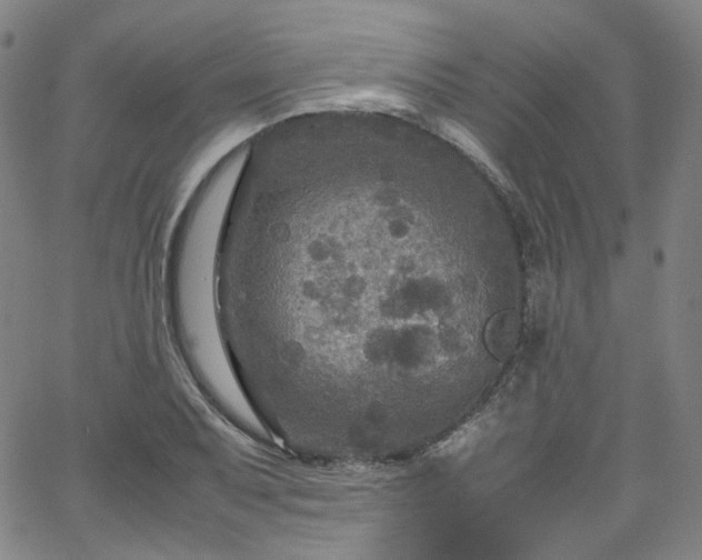 X0000065981079200603101416