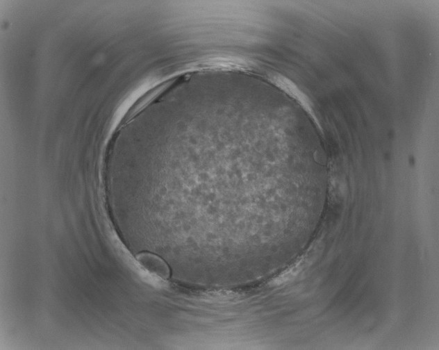 X0000065981091200603101416