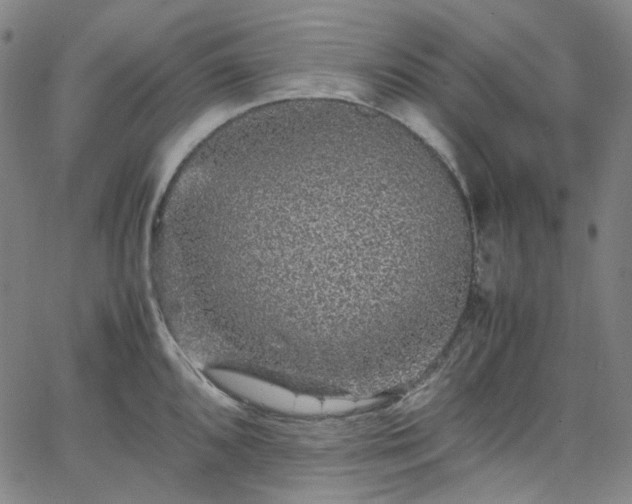 X0000065981096200603101416