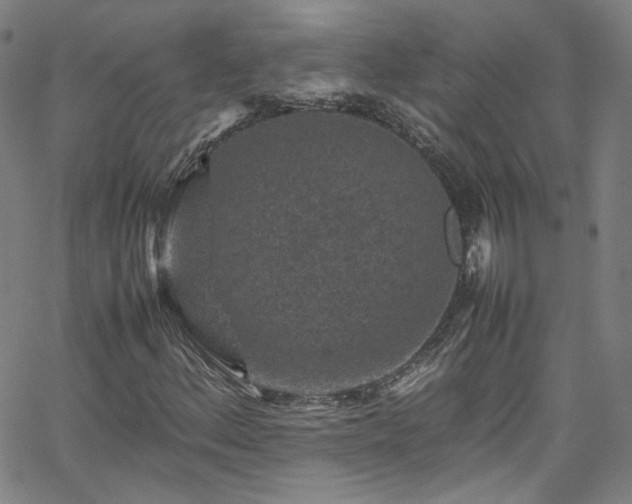 X0000065981156200603101415