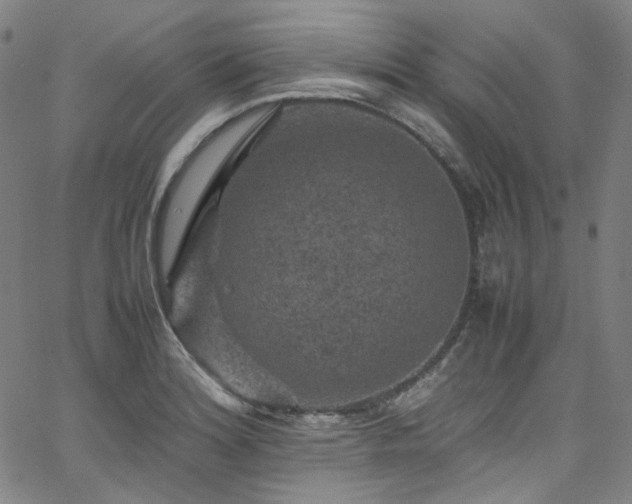 X0000065981180200603101415