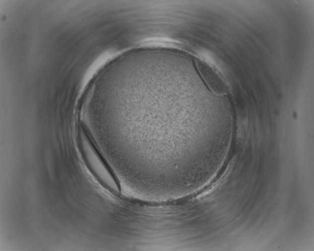 X0000065981376200603101411