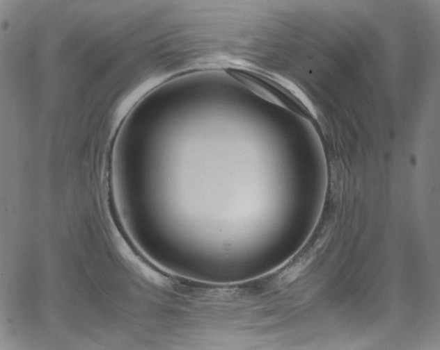 X0000065981387200603101411