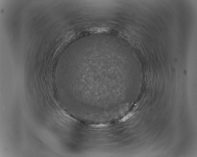 X0000065981393200603101410