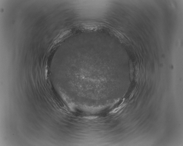 X0000065981394200603101410