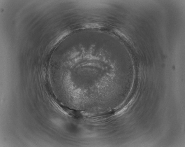 X0000065981401200603101410