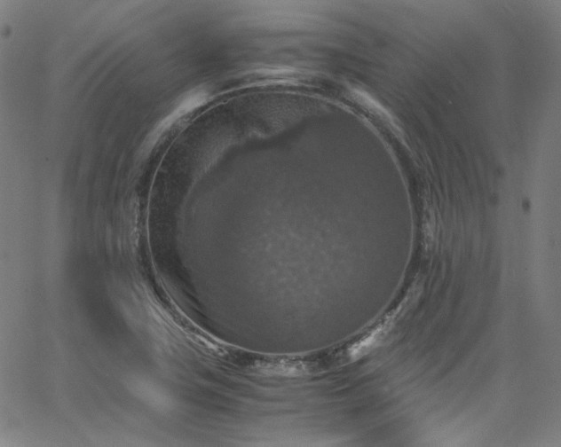 X0000065981411200603101411