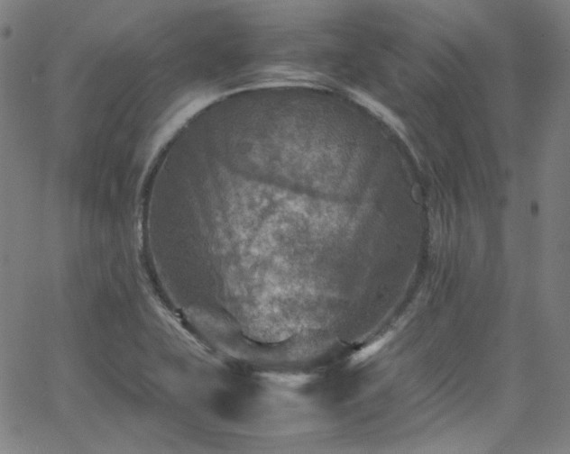 X0000065981415200603101411