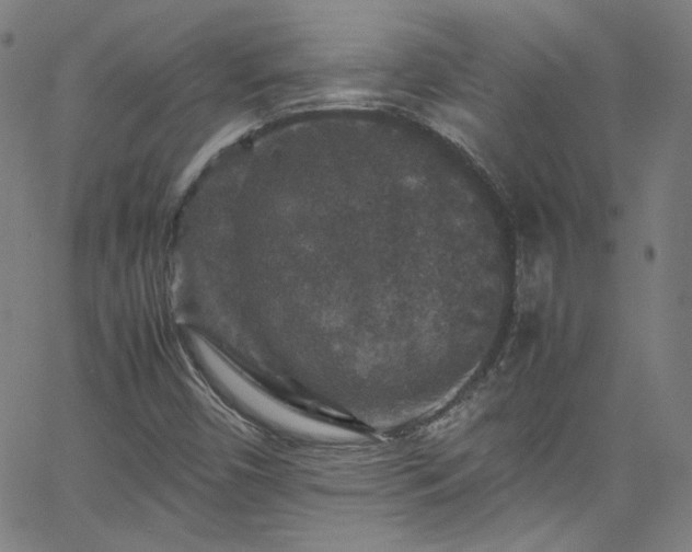 X0000065981450200603101410